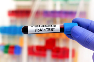 HbA1c-test