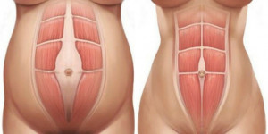 Abdominal muscles